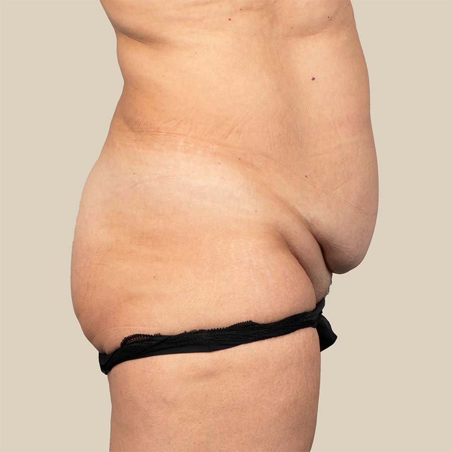 Voor